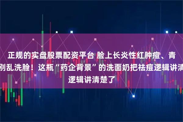 正规的实盘股票配资平台 脸上长炎性红肿痘、青春痘别乱洗脸！这瓶“药企背景”的洗面奶把祛痘逻辑讲清楚了